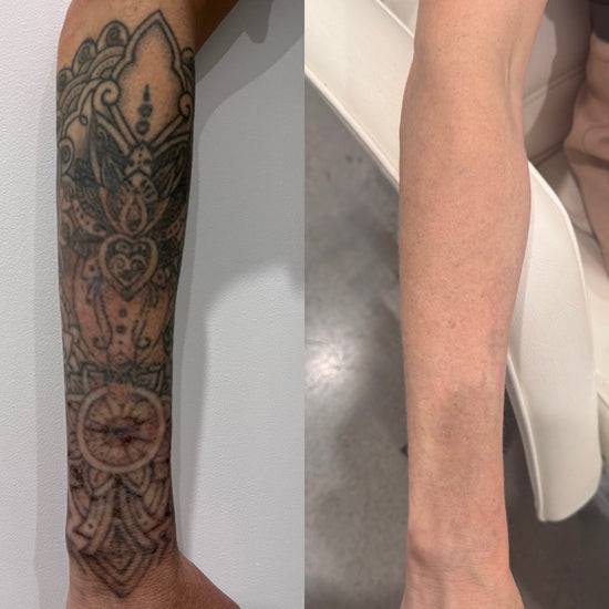 14 sessions